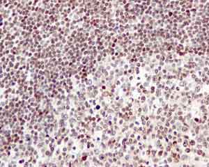 Immunohistochemistry (Formalin/PFA-fixed paraffin-embedded sections) - Anti-5 Lipoxygenase/5-LO antibody [EP6072(2)] (AB169755), expandable thumbnail