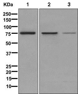 Western blot - Anti-5 Lipoxygenase/5-LO antibody [EP6072(2)] (ab169755), expandable thumbnail