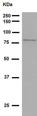 Western blot - Anti-5 Lipoxygenase/5-LO antibody [EP6072(2)] (ab169755), expandable thumbnail
