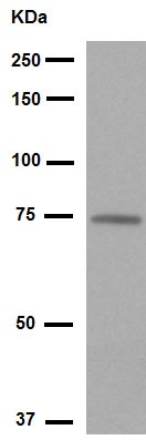 Western blot - Anti-5 Lipoxygenase/5-LO antibody [EP6072(2)] (ab169755), expandable thumbnail