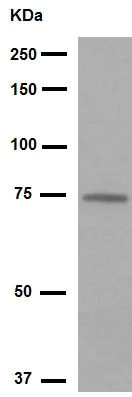 Western blot - Anti-5 Lipoxygenase/5-LO antibody [EP6072(2)] (AB169755)