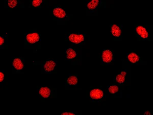 Immunocytochemistry/ Immunofluorescence - Anti-5 Lipoxygenase/5-LO antibody [EP6072(2)] - BSA and Azide free (AB227991)
