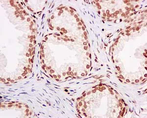 Immunohistochemistry (Formalin/PFA-fixed paraffin-embedded sections) - Anti-5 Lipoxygenase/5-LO antibody [EP6072(2)] - BSA and Azide free (AB227991)