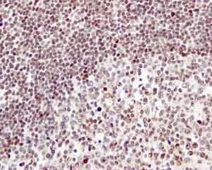 Immunohistochemistry (Formalin/PFA-fixed paraffin-embedded sections) - Anti-5 Lipoxygenase/5-LO antibody [EP6072(2)] - BSA and Azide free (AB227991)