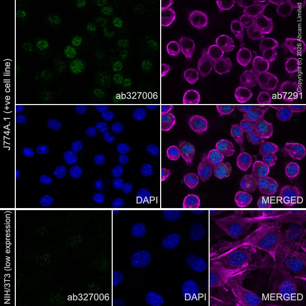 Immunocytochemistry/ Immunofluorescence - Anti-5 Lipoxygenase/5-LO antibody [EPR30234-556] (AB327006)