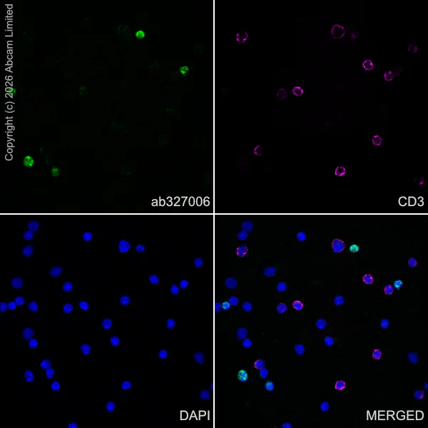 Immunocytochemistry/ Immunofluorescence - Anti-5 Lipoxygenase/5-LO antibody [EPR30234-556] (AB327006)
