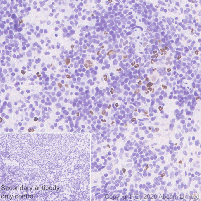 Immunohistochemistry (Formalin/PFA-fixed paraffin-embedded sections) - Anti-5 Lipoxygenase/5-LO antibody [EPR30234-556] (AB327006)