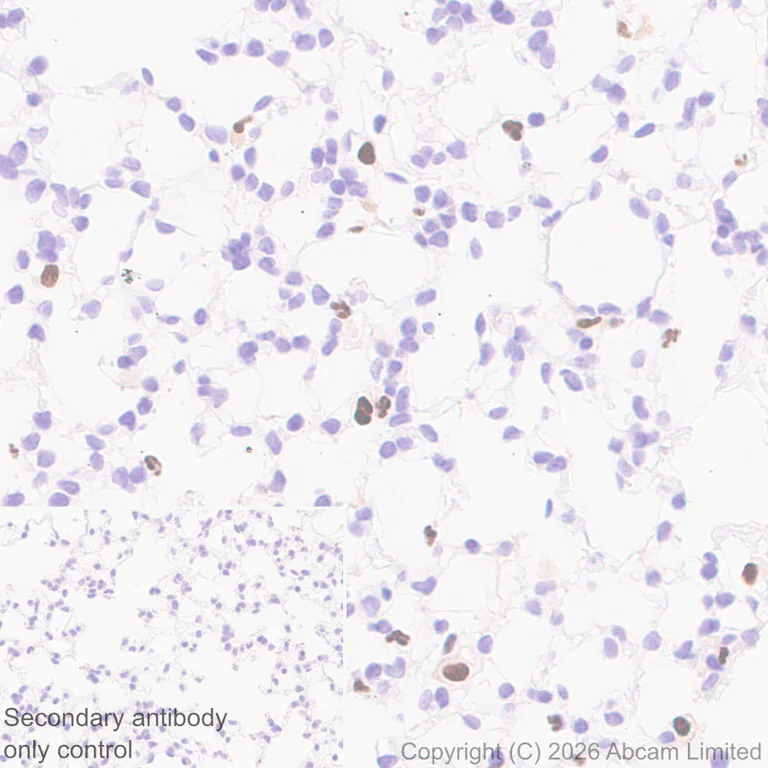 Immunohistochemistry (Formalin/PFA-fixed paraffin-embedded sections) - Anti-5 Lipoxygenase/5-LO antibody [EPR30234-556] (AB327006)