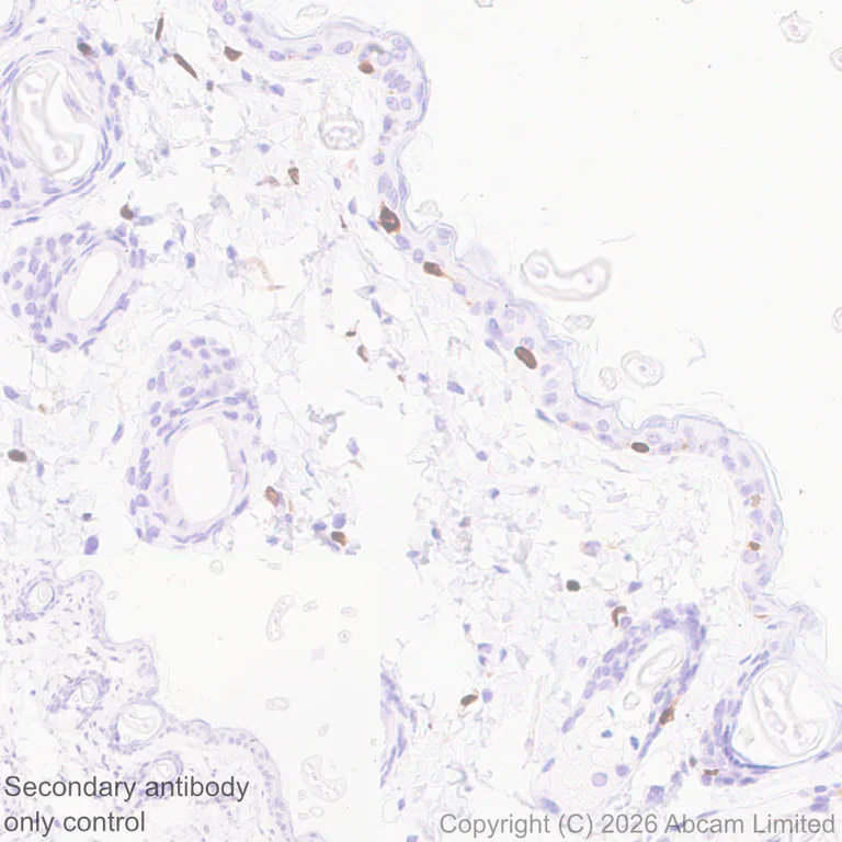Immunohistochemistry (Formalin/PFA-fixed paraffin-embedded sections) - Anti-5 Lipoxygenase/5-LO antibody [EPR30234-556] (AB327006)