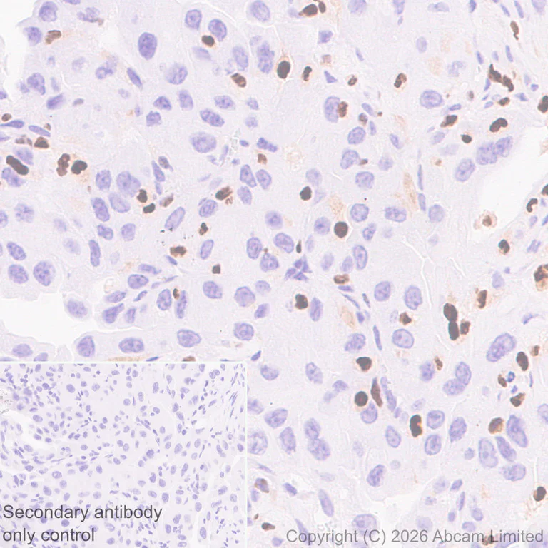 Immunohistochemistry (Formalin/PFA-fixed paraffin-embedded sections) - Anti-5 Lipoxygenase/5-LO antibody [EPR30234-556] (AB327006)