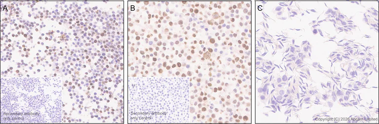 Immunohistochemistry (Formalin/PFA-fixed paraffin-embedded sections) - Anti-5 Lipoxygenase/5-LO antibody [EPR30234-556] (AB327006)