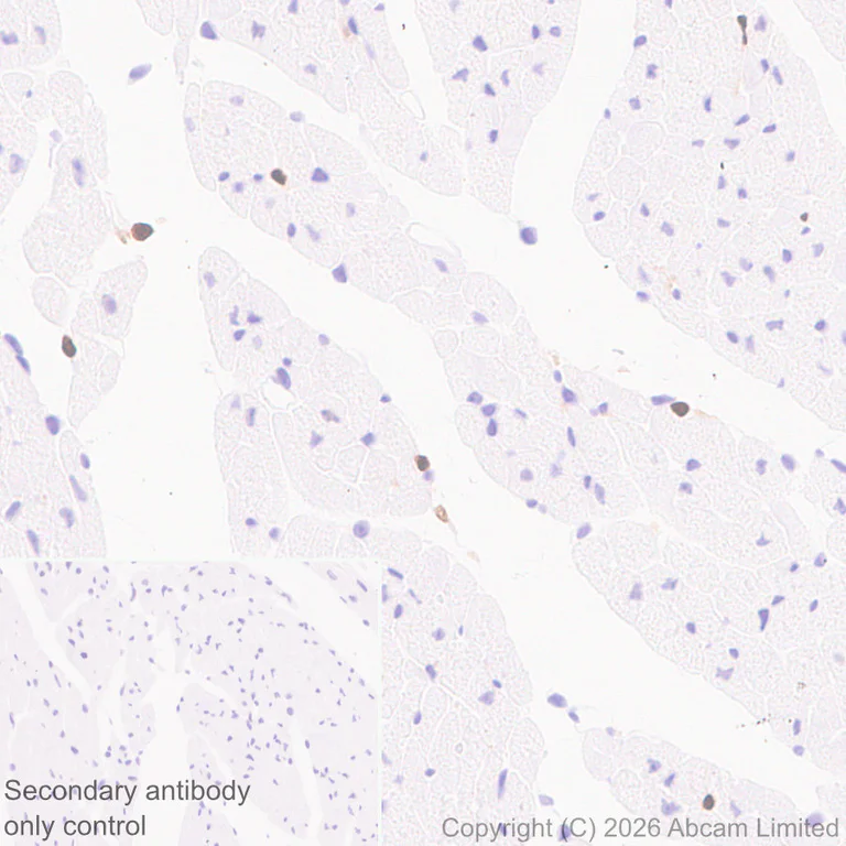 Immunohistochemistry (Formalin/PFA-fixed paraffin-embedded sections) - Anti-5 Lipoxygenase/5-LO antibody [EPR30234-556] (AB327006)