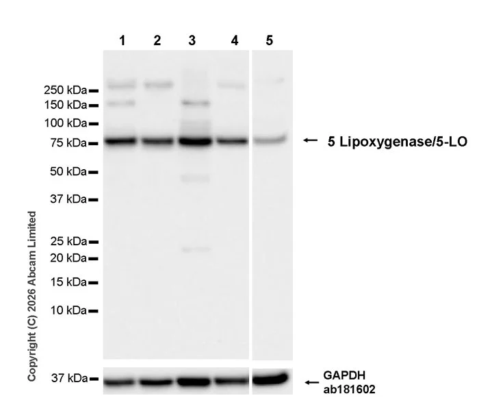 Western blot - Anti-5 Lipoxygenase/5-LO antibody [EPR30234-556] (AB327006)