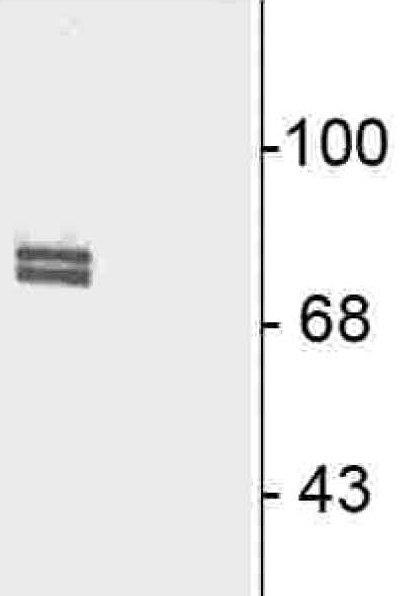 Western blot - Anti-5 Lipoxygenase/5-LO (phospho S523) antibody (AB30573), expandable thumbnail