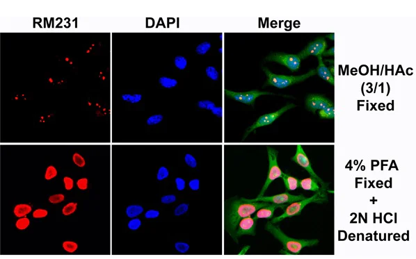 Immunocytochemistry - Anti-5-methylcytosine (5-mC) antibody [RM231] (AB214727)