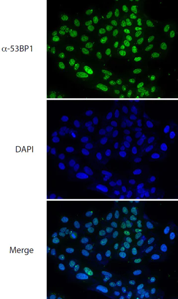 Immunocytochemistry/ Immunofluorescence - Anti-53BP1 antibody (AB172580)