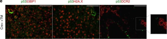 Immunocytochemistry/ Immunofluorescence - Anti-53BP1 antibody (AB172580)