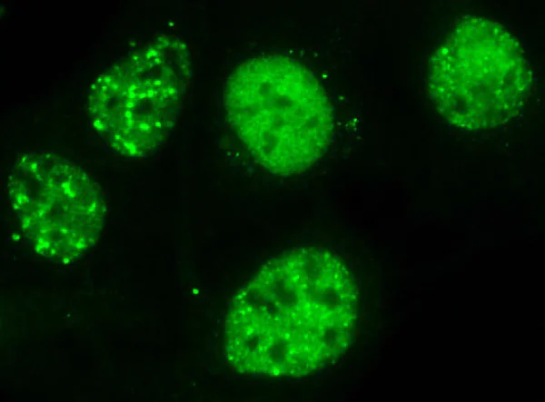 Immunocytochemistry/ Immunofluorescence - Anti-53BP1 antibody (AB172580)