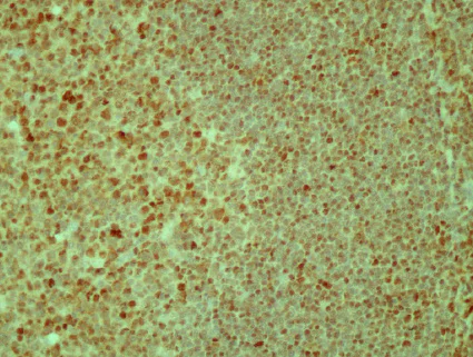 Immunohistochemistry (Formalin/PFA-fixed paraffin-embedded sections) - Anti-53BP1 antibody (AB172580)