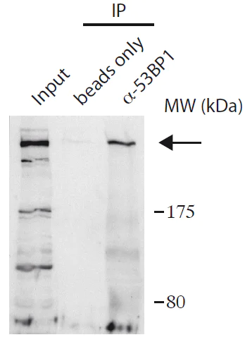 Immunoprecipitation - Anti-53BP1 antibody (AB172580)