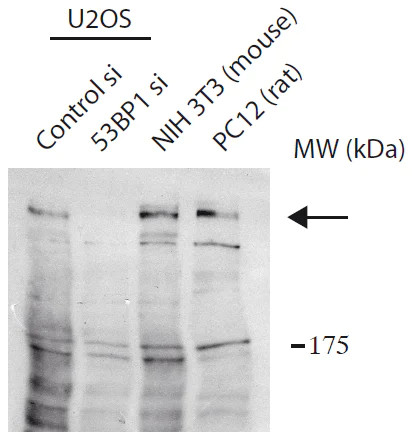Western blot - Anti-53BP1 antibody (AB172580)