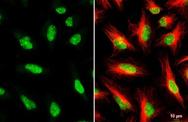 Immunocytochemistry/ Immunofluorescence - Anti-53BP1 antibody (AB21083)