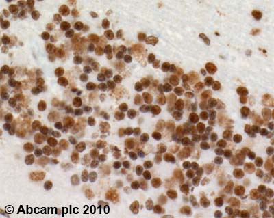Immunohistochemistry (Formalin/PFA-fixed paraffin-embedded sections) - Anti-53BP1 antibody (ab21083), expandable thumbnail