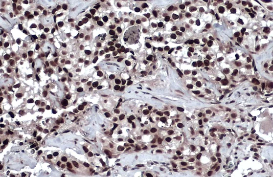 Immunohistochemistry (Formalin/PFA-fixed paraffin-embedded sections) - Anti-53BP1 antibody (AB21083)