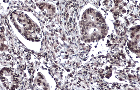 Immunohistochemistry (Formalin/PFA-fixed paraffin-embedded sections) - Anti-53BP1 antibody (AB21083)
