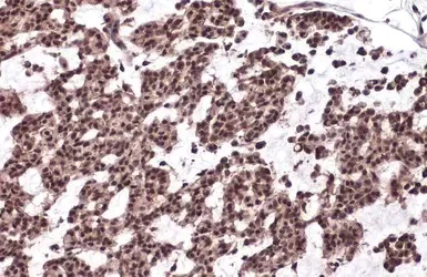 Immunohistochemistry (Formalin/PFA-fixed paraffin-embedded sections) - Anti-53BP1 antibody (AB21083)
