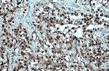 Immunohistochemistry (Formalin/PFA-fixed paraffin-embedded sections) - Anti-53BP1 antibody (AB21083)
