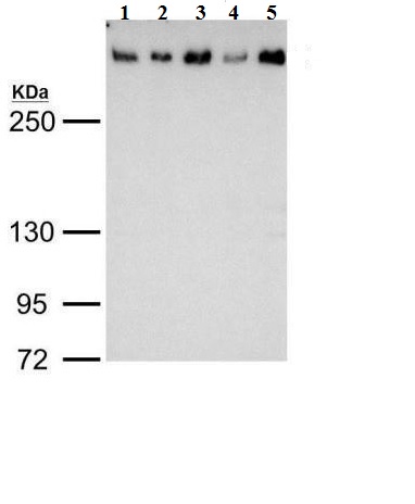Western blot - Anti-53BP1 antibody (AB21083), expandable thumbnail