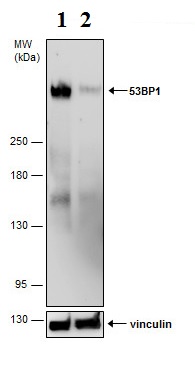 Western blot - Anti-53BP1 antibody (AB21083), expandable thumbnail