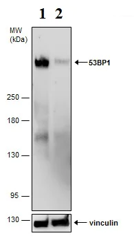 Western blot - Anti-53BP1 antibody (AB21083)