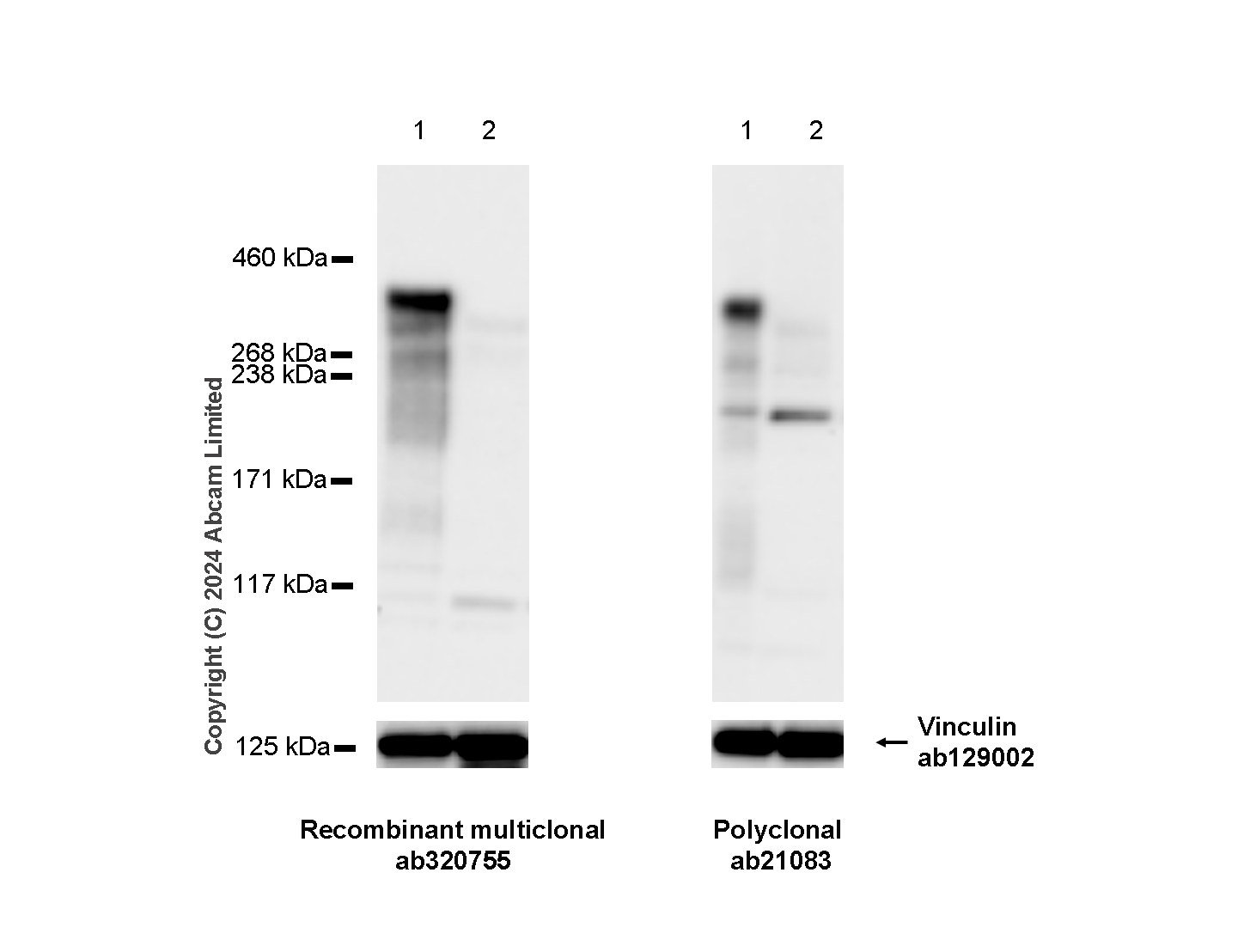Western blot - Anti-53BP1 antibody (ab21083), expandable thumbnail