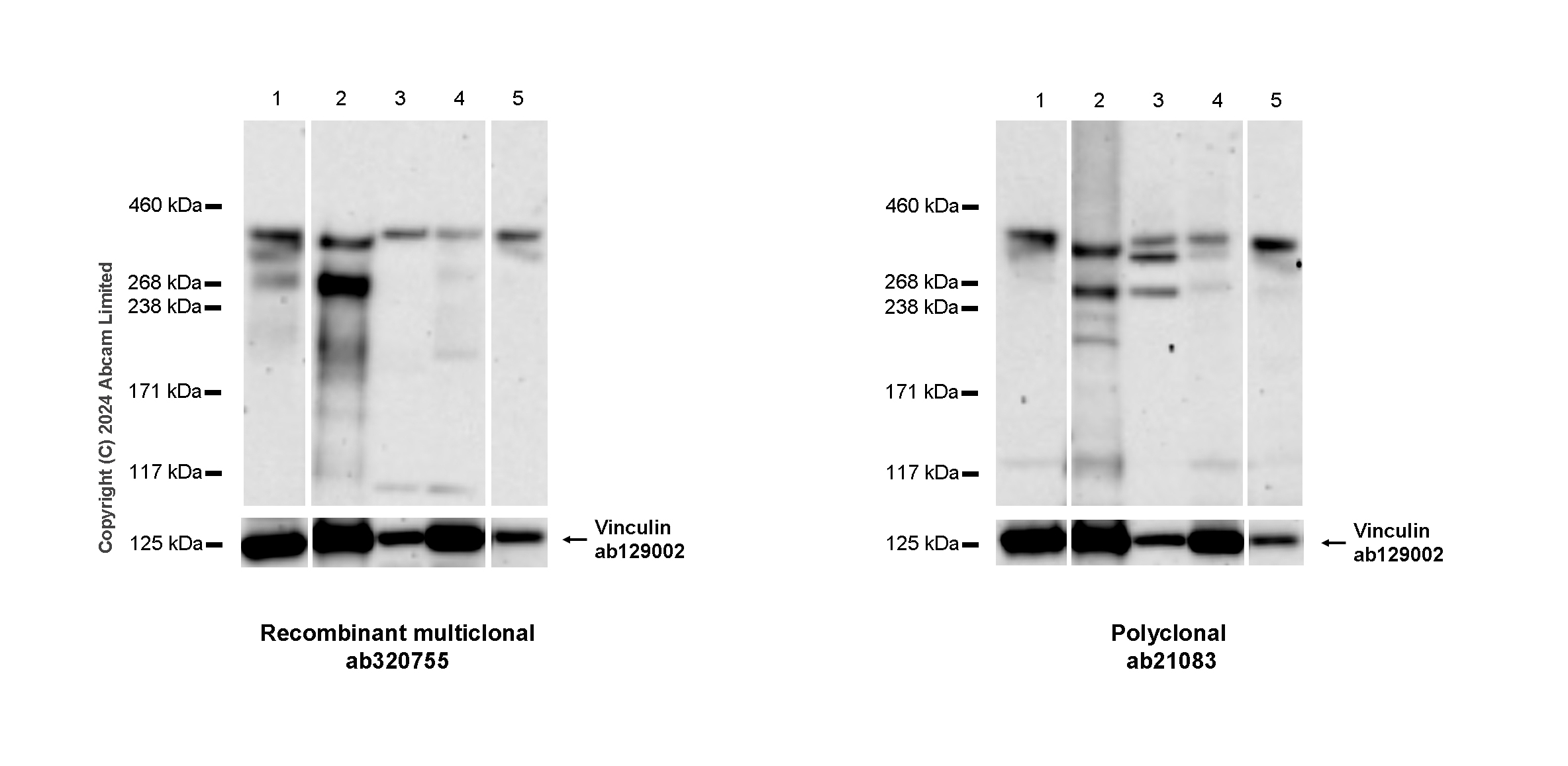 Western blot - Anti-53BP1 antibody (ab21083), expandable thumbnail