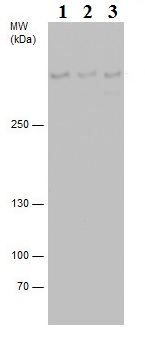 Western blot - Anti-53BP1 antibody (AB21083), expandable thumbnail