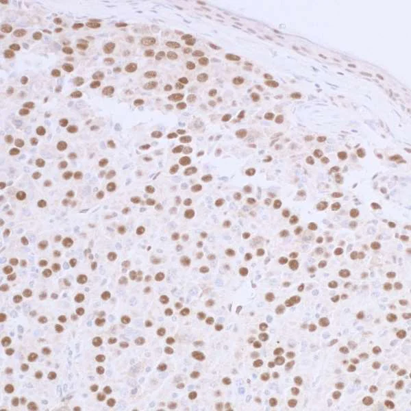 Immunohistochemistry (Formalin/PFA-fixed paraffin-embedded sections) - Anti-53BP1 antibody (AB36823)
