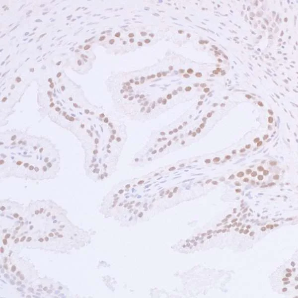 Immunohistochemistry (Formalin/PFA-fixed paraffin-embedded sections) - Anti-53BP1 antibody (AB36823)