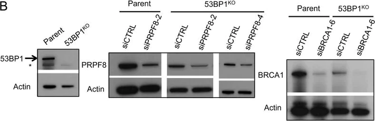 Western blot - Anti-53BP1 antibody (AB36823)