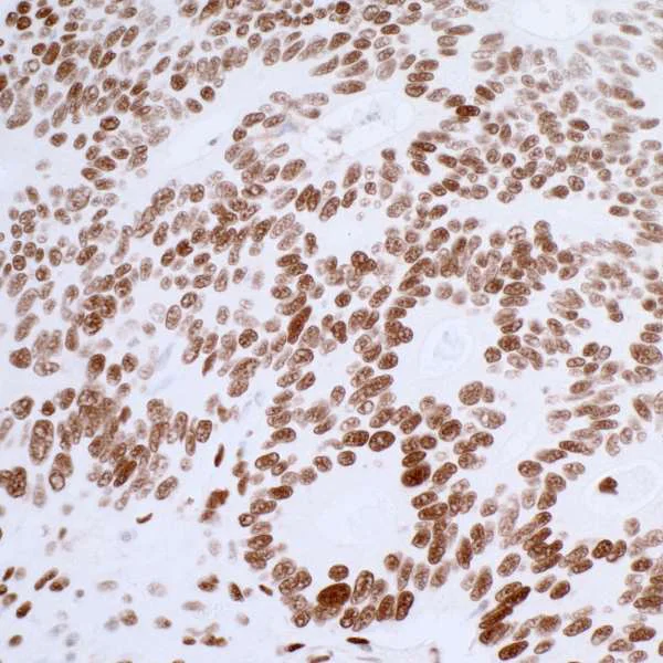 Immunohistochemistry (Formalin/PFA-fixed paraffin-embedded sections) - Anti-53BP1 antibody [BL-250-1H11] (AB243868)