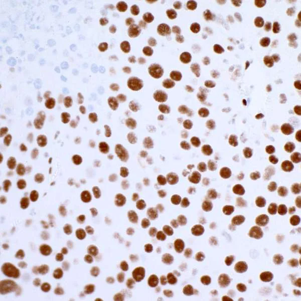 Immunohistochemistry (Formalin/PFA-fixed paraffin-embedded sections) - Anti-53BP1 antibody [BL-250-1H11] (AB243868)