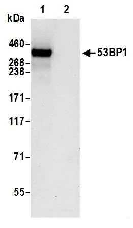 Immunoprecipitation - Anti-53BP1 antibody [BL-250-1H11] (AB243868)