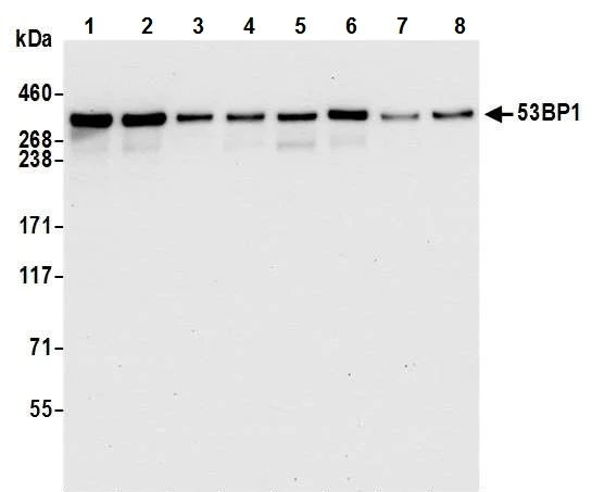 Western blot - Anti-53BP1 antibody [BL-250-1H11] (AB243868)