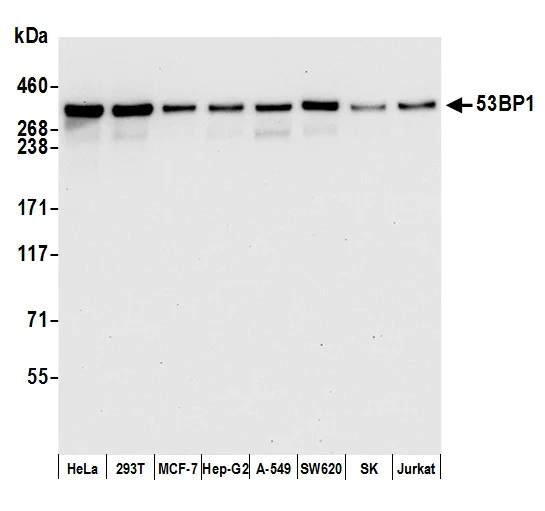 Western blot - Anti-53BP1 antibody [BL-250-1H11] (AB243868)