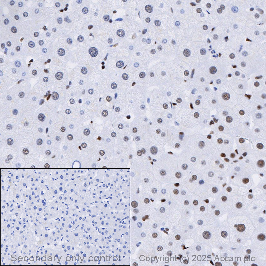 Immunohistochemistry (Formalin/PFA-fixed paraffin-embedded sections) - Anti-53BP1 antibody [EPR2172(2)] (AB175933)