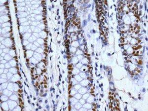 Immunohistochemistry (Formalin/PFA-fixed paraffin-embedded sections) - Anti-53BP1 antibody [EPR2172(2)] - BSA and Azide free (AB222232)