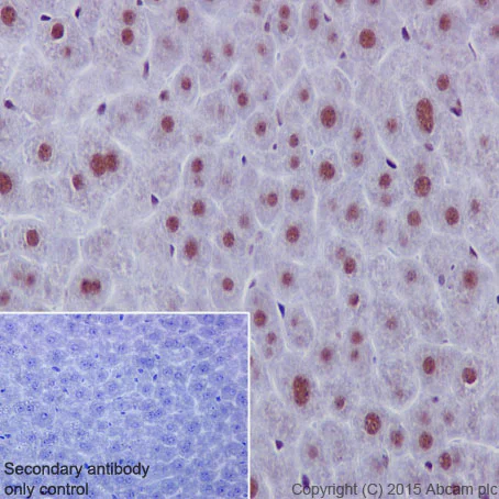 Immunohistochemistry (Formalin/PFA-fixed paraffin-embedded sections) - Anti-53BP1 antibody [EPR2172(2)] - BSA and Azide free (AB222232)