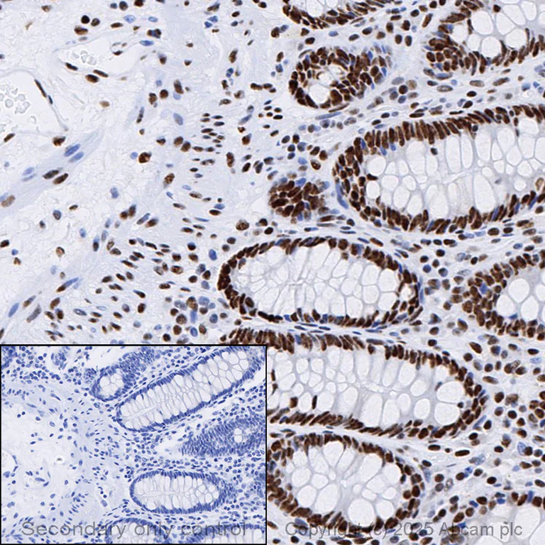 Immunohistochemistry (Formalin/PFA-fixed paraffin-embedded sections) - Anti-53BP1 antibody [EPR2172(2)] - BSA and Azide free (AB222232)