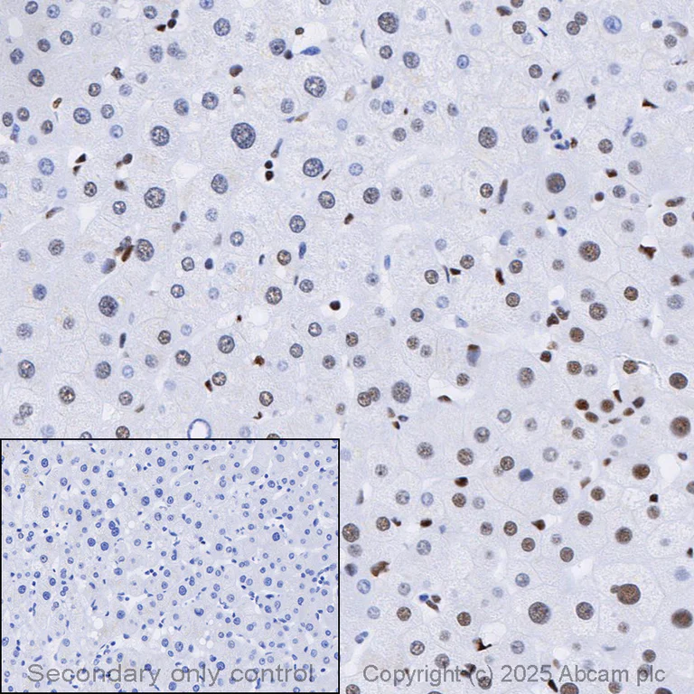 Immunohistochemistry (Formalin/PFA-fixed paraffin-embedded sections) - Anti-53BP1 antibody [EPR2172(2)] - BSA and Azide free (AB222232)